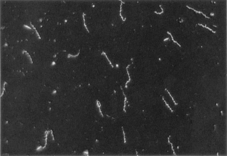 SEXUALLY TRANSMITTED DISEASES Fig. 9. Appearance of T. pallidum under dark-field microscopy [Negative] Use the low-power objective ( 10) to bring the specimen into focus.