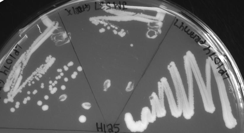 Lab 2C: Streak out bacteria colonies In last week s lab you plated the bacteria library on selective media (LB-Kan) to select for cells that were transformed with a plasmid from the library.