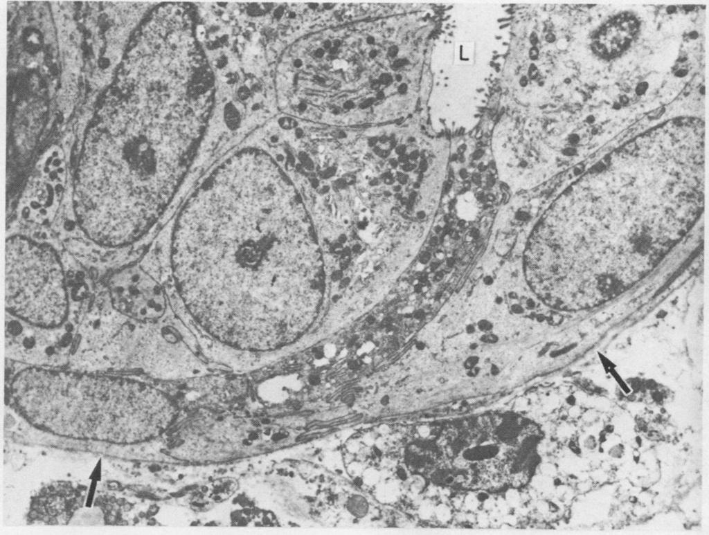 Growth of crypt cell nodules in duodenal mucosa in man during organ culture in vitro others were small and sometimes seemed to be surrounded by the crypt wall.