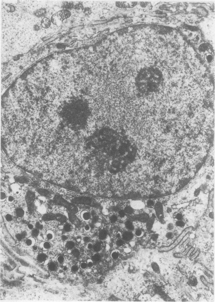V = vacuole. Electron micrograph x 8000. Fig. 7 8500.