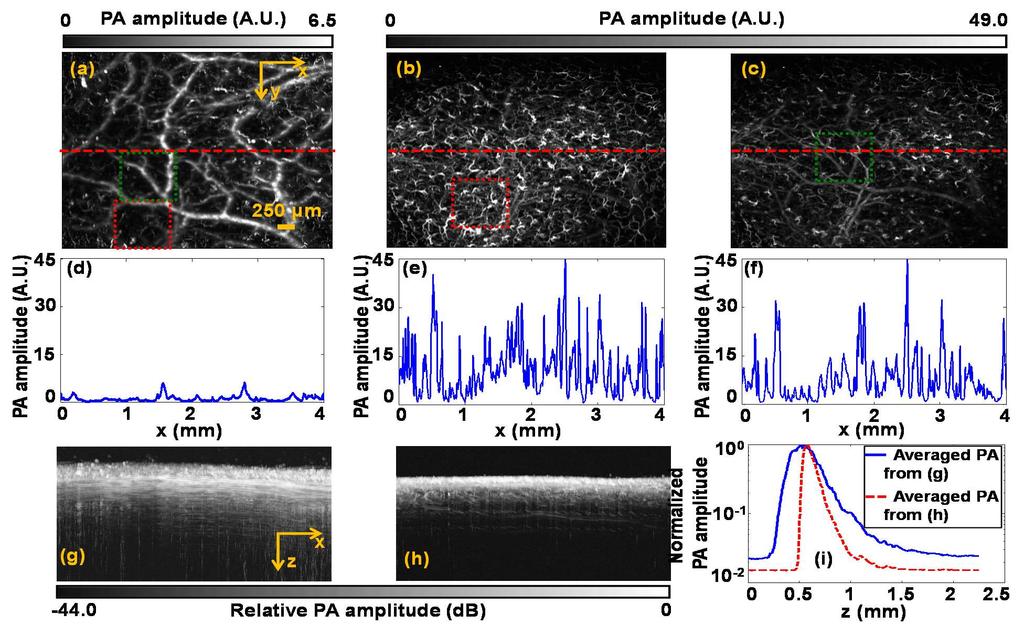 Figure 2.3 In vivo PAM of mouse scalp facilitated by optical clearing. (a) PAM image before optical clearing. (b) PAM image with capillaries after optical clearing.
