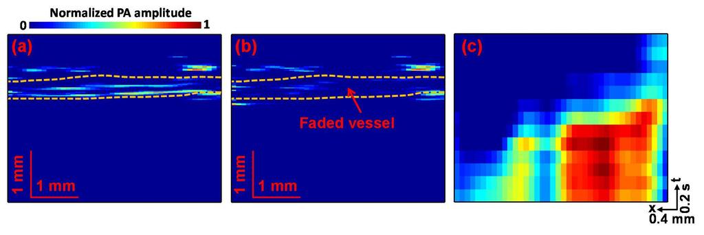 mm/s, indicating that our method can measure deep blood flow with high accuracy. Thus, we concluded that our method should be able to measure blood flow velocity in vivo. Figure 4.