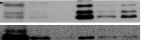 Aliquots of P2 fractions were incubated with or without micrococcal nuclease (MNase).