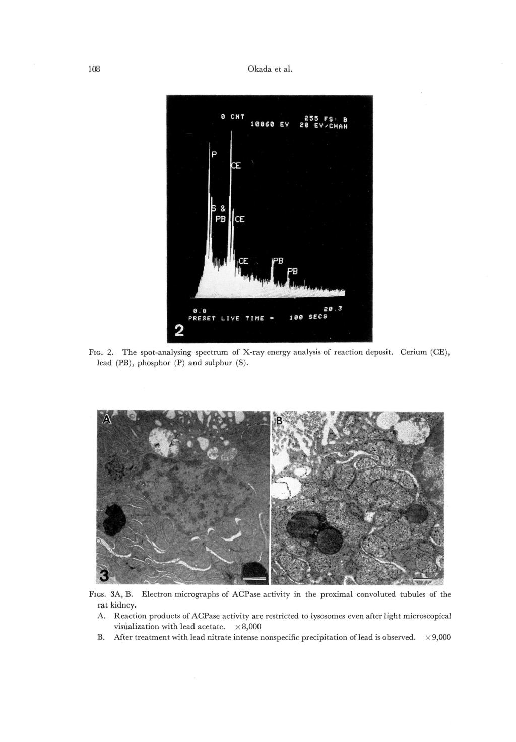 Okada 108 et al. FIG. 2. The spot-analysing spectrum of X-ray energy analysis of reaction deposit. lead (PB), phosphor (P) and sulphur (S). Cerium (CE), FIGS. 3A, B. tubules rat kidney. A. Reaction B.