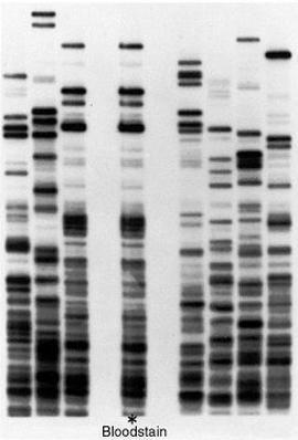 *DNA Fingerprinting ---What is a DNA fingerprint?
