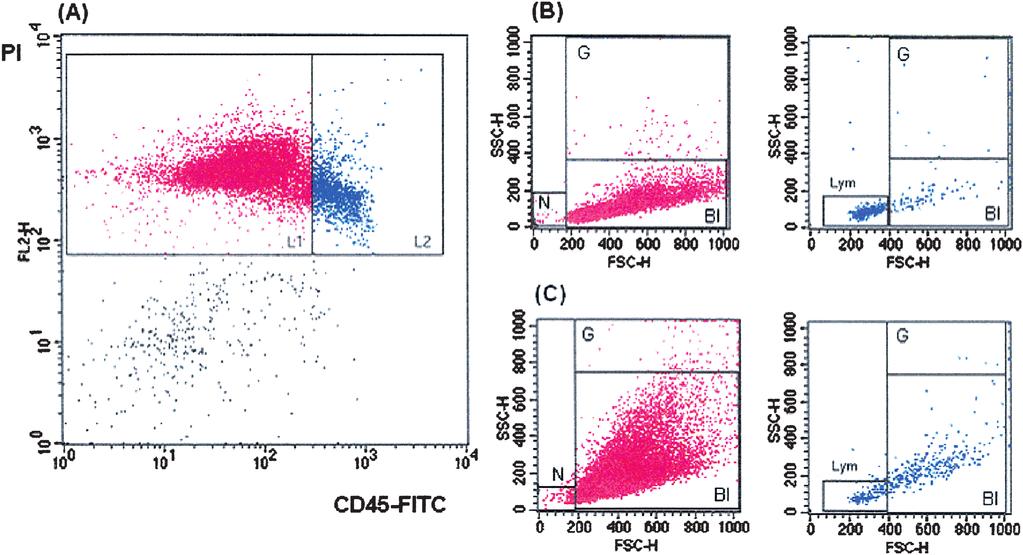 Automated analysis of bone marrow aspirates 311 Fig. 3. Flow cytometric analysis of two patients with acute leukemia. In the first step, two groups of cells were gated (panel A).