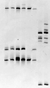 Algorithm for genetic diagnosis of bleeding disorders [CMC, Vellore] Uniplex PCR Fibrinogen