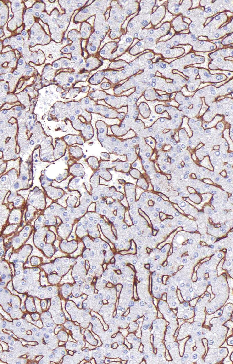 GeneAb TM Collagen Type IV Clone: IHC549 Source: Mouse Monoclonal Positive Control: Lung, Muscle 1. Intended Use This antibody is intended for in vitro diagnostic (IVD) use.