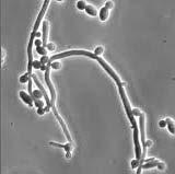 produced by yeast metabolism, where Candida strains has become important over Saccharomyces