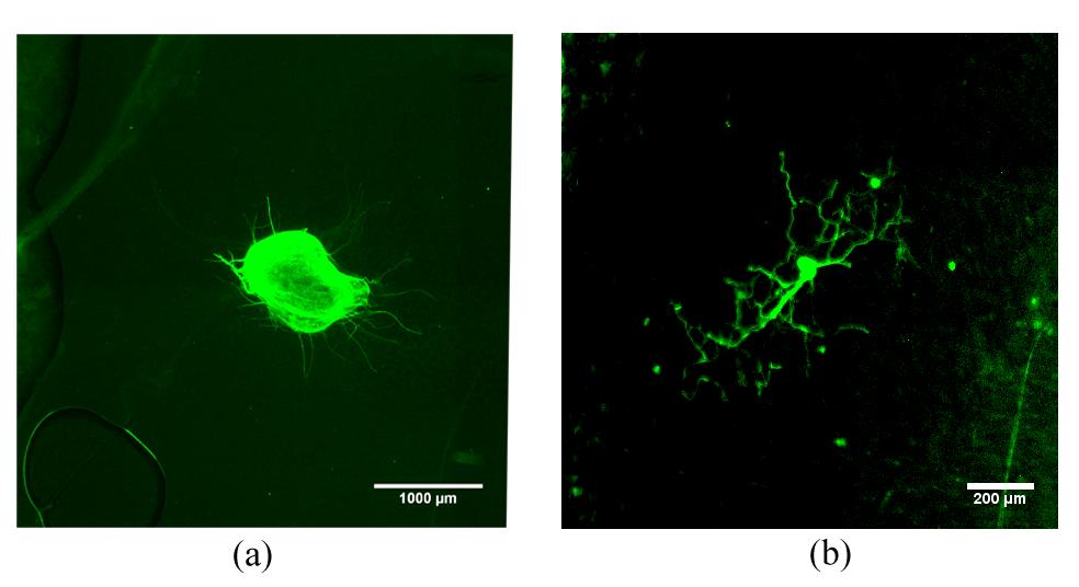 by β-iii tubulin, S-100 and merged image, respectively; (d-f) 20 x magnifications of explant stained by β-iii tubulin for neurons