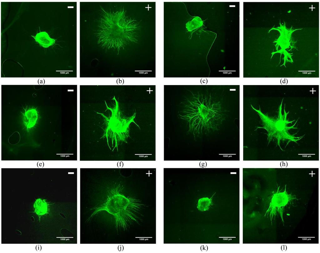 Figure 3.13 Immunofluorescent staining of DRG explants cultured on the collagen and collagengenipin gels for 10 days in DMEM/10 % HS medium enriched with (+) or without (-) NGF.