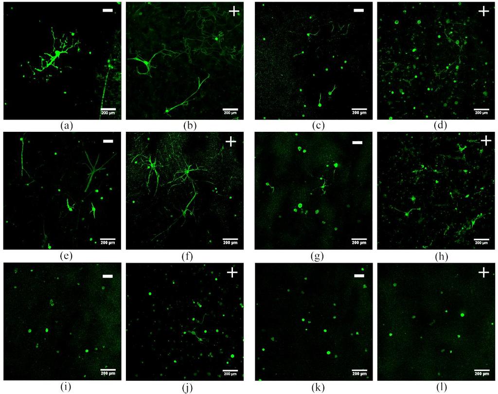 Figure 3.20 Confocal microscopy of dissociated DRG neurons encapsulated and cultured within collagen and collagen-genipin hydrogels for 10 days.