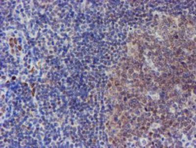 1 Updated 7/16/2018 Staining of paraffin-embedded Human tonsil using anti-elk3 mouse monoclonal antibody.