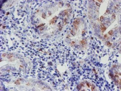 1 Updated 7/16/2018 Staining of paraffin-embedded Adenocarcinoma of Human