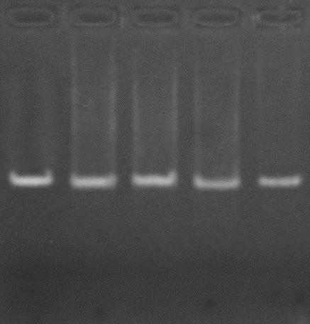 1 2 3 4 5 Sản phẩm PCR Hình 06.