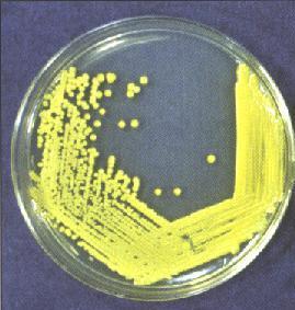 Pure Cultures Contain only one species or strain. Most patient specimens and environmental samples contain several different kinds of bacteria Streak-plate method is commonly used.
