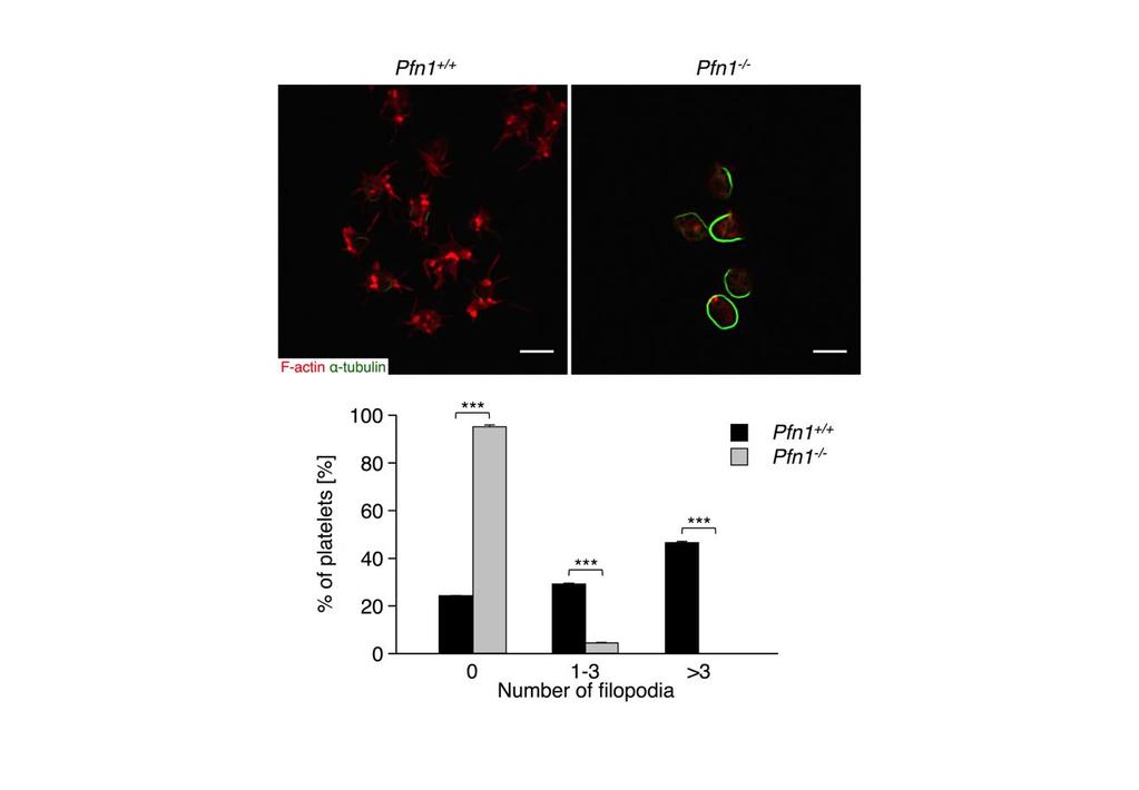 Supplementary Figure 8 Pre-treatment with colchicine cannot rescue filopodia formation of Pfn1 -/- platelets on von-willebrand factor.