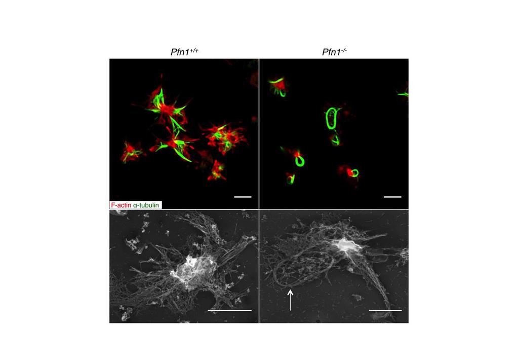 Supplementary Figure 9 Pfn1 -/- platelets fail to reorganize their microtubule coils on CRP.