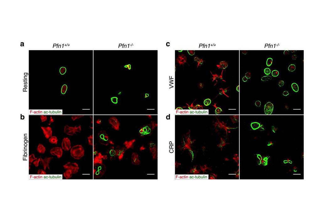 Supplementary Figure 10 Pfn1 -/- platelets contain highly acetylated microtubules that cannot be reorganized. (a) Resting control and Pfn1 -/- platelets contain highly acetylated microtubules.