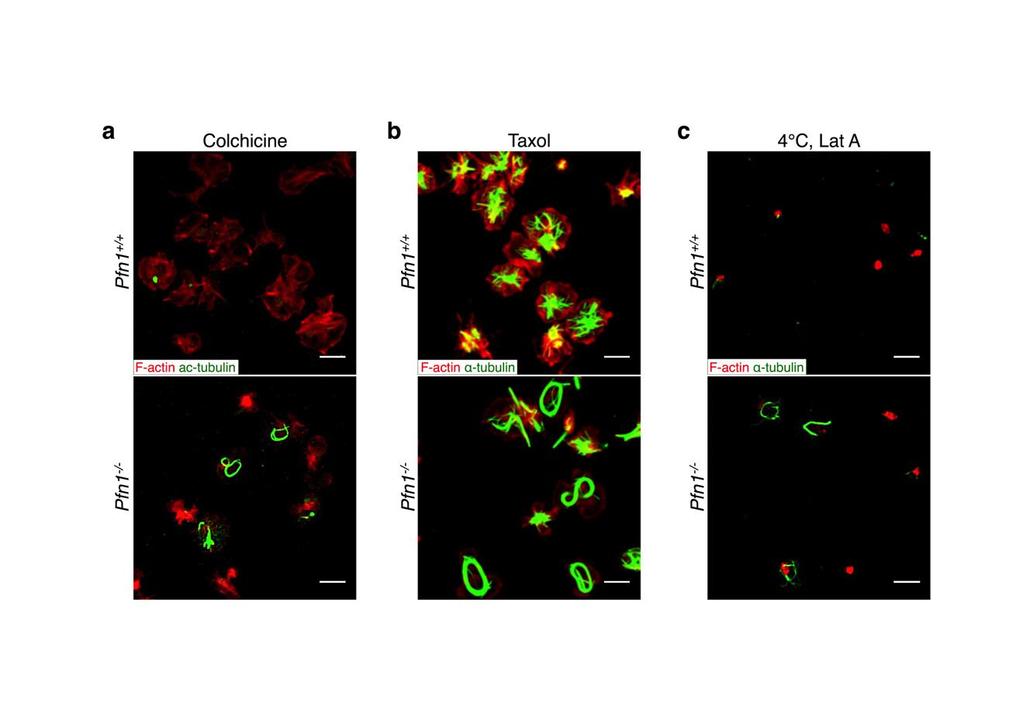Supplementary Figure 11 The actin cytoskeleton does not contribute to increased microtubule stability in Pfn1 -/- platelets.