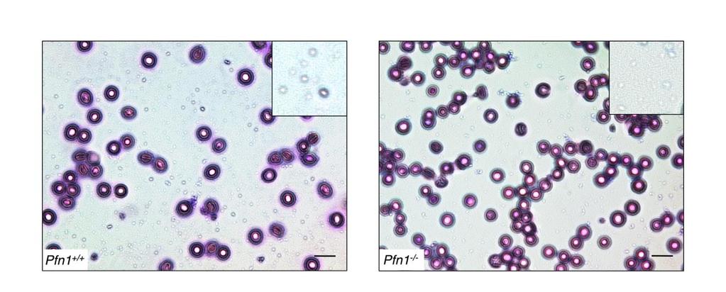 Supplementary Figure 2 Microthrombocytopenia in Pfn1 -/- mice shown in blood smears.