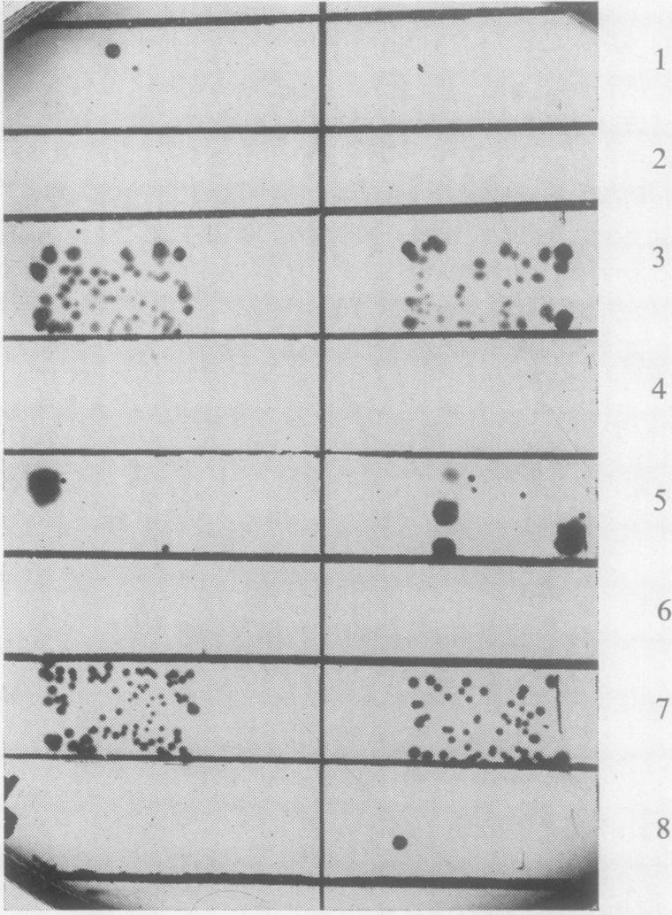 t was found that in 72 urines no growth occurred on the inoculum area of the blotting-paper test whereas growth was present on the surface viable count plate.