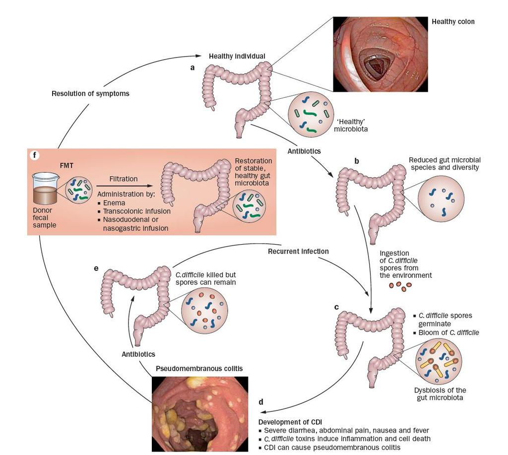 Microbiome and Health Borody & Khoruts