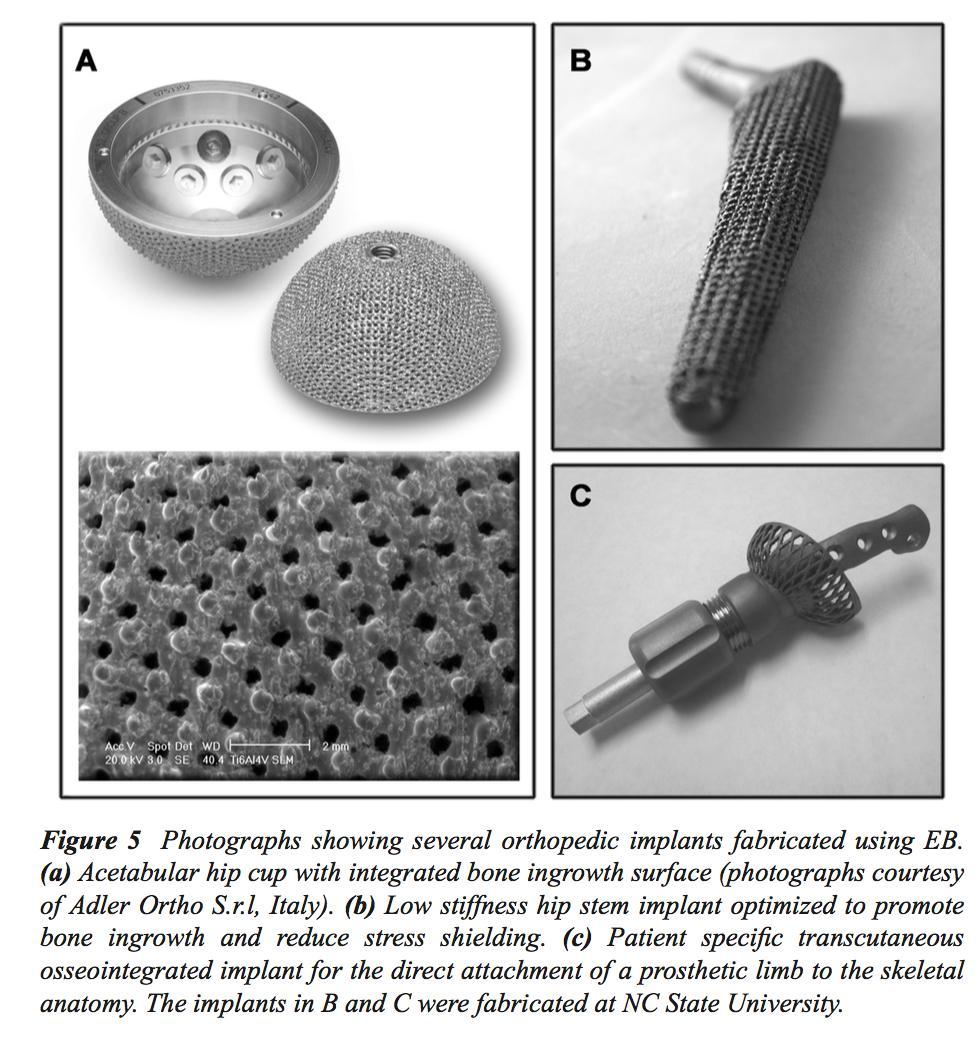 Additive manufacturing of orthopedic implants One of the primary this is that engineered