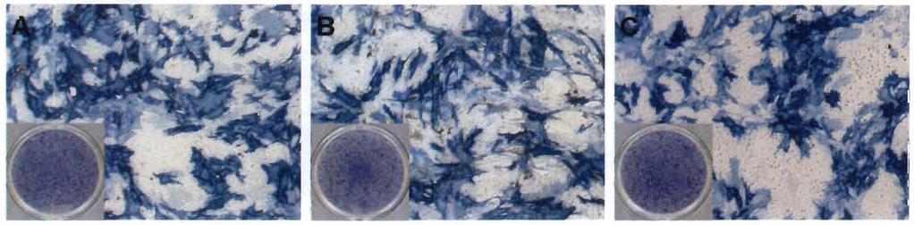 53 MSC- CC400- CC1000- MSC+ CC400+ CC1000+ Figure 111-4: Alkaline phosphatase staining of wells after 8 days of culture with MSCs alone (MSC) or MSCs and HSPCs in co-culture (CC) at specified seeding