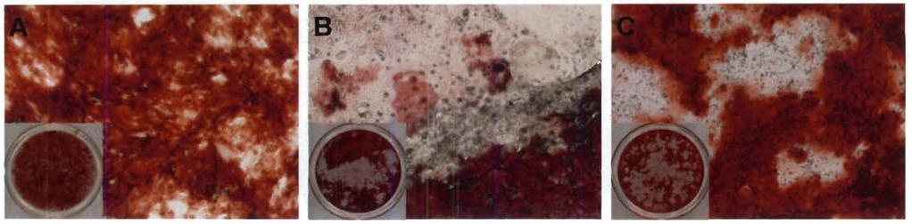 55 CC400- CC1000- CC400+ CC1000+ Figure 111-6: Alizarin Red staining of wells after 24 days of culture with MSCs alone (MSC) or MSCs and HSPCs in co-culture (CC) at specified seeding densities (400