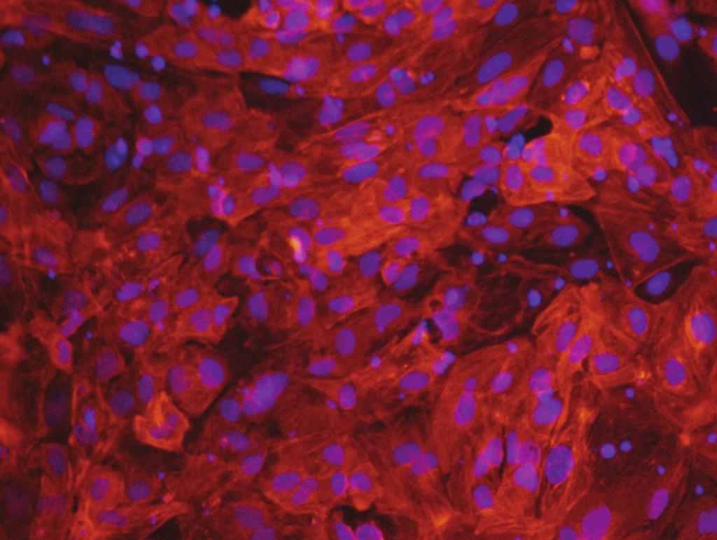 Aside from visually observing contracting cells, commitment to the cardiomyocyte cell fate was evaluated by labeling with the Anti-Human Cardiac Troponin T antibody included in this kit.