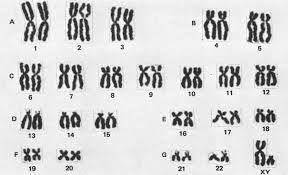 Karyotypes Human genome full set of genetic information that a human carries in their DNA Chromosomes photographed during mitosis Chromosomes condensed and easy to view A karyotype