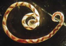 Nonindigenous Snails Acting as Intermediate Hosts for Parasites Affecting Human