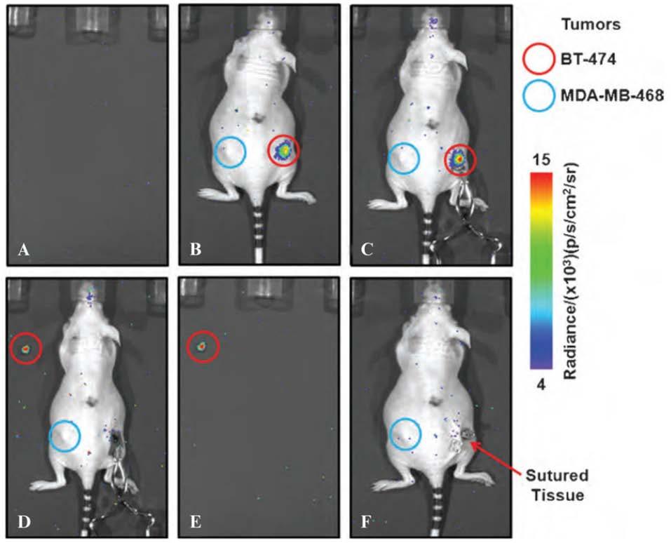 supported the development of CLI as a possible clinical tool in surgical procedures for defining tumour margins. Figure 8 Cerenkov image guided surgery performed on a mouse by Holland et al.