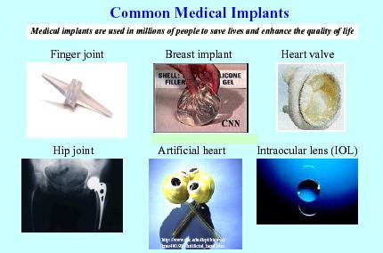 Some Biomedical Implant