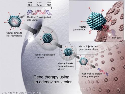 A new gene is injected into an adenovirus vector, which is used to introduce the modified DNA into a human cell.