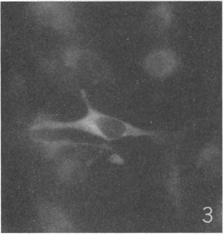 Minute areas of fluorescence seen 8 hr after infection. FIG. 3.