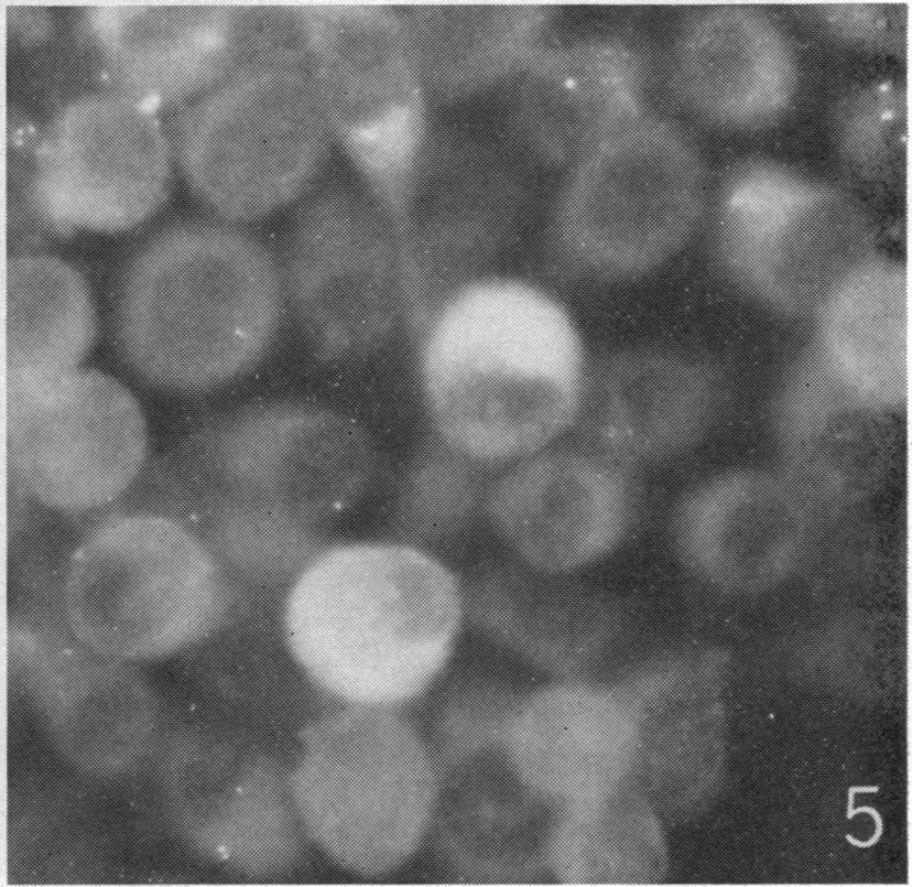 Note dense and granular appearance of fluorescent viral antigen. FIG. 5.