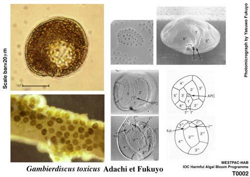 Gambierdiscus toxicus Epiphytic dinoflagellate (attaches to structures in GOMEX) Tropical-subtropical regions Causes ciguatera poisoning Toxin accumulates in fish & transferred to