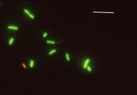 10 µm DAPI (4,6-diamidino-2-phenylindiole) stains intracellularly by binding to ATclusters in the DNA.