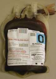 Transfusion Science identify blood groups for blood donation ensure correct blood group is matched to the patient receiving