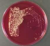 micro-organisms establish the antibiotic treatment required to