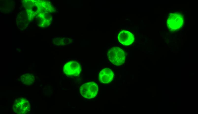 A-033 and 2 µg of pmaxgfp Vector. Cells were analyzed 24 hours post Nucleofection using light (A) and fluorescence microscopy (B).