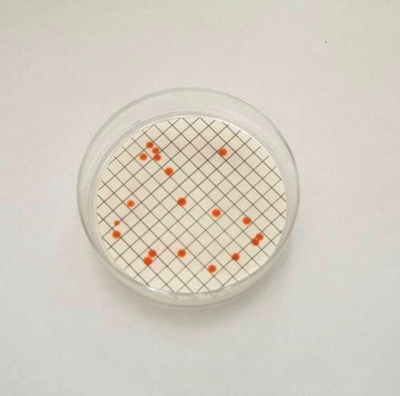 and orange in colour. Large numbers of colonies on membrane filters may restrict the size of individual colonies and a hand lens may be required.