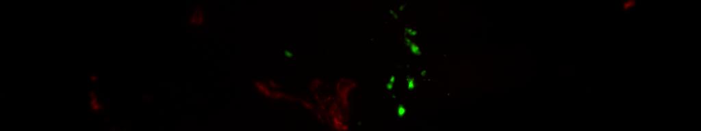 Immunofluorescent staining of CD31 (red) and GFP cells (green) in TIB6,, and tumor sections isolated from mice