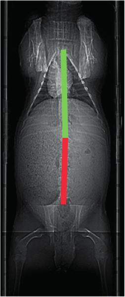 production Muscularity measures Linear measurements of individual muscles and muscle groups from CT images can give an idea