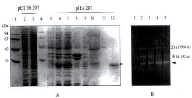 30 Fig. 2: Overexpression and purification of P207 by pet vectors. (A) Overexpression of pet 3b 207 and phis 207. The band corresponding to the purified His-P207 was indicated by an arrow.