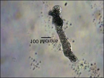 This image was taken 20 minutes after the amoeba was exposed to Cytocholasin B. In this picture, the pseudopod is much more extended and is only forming in one direction.