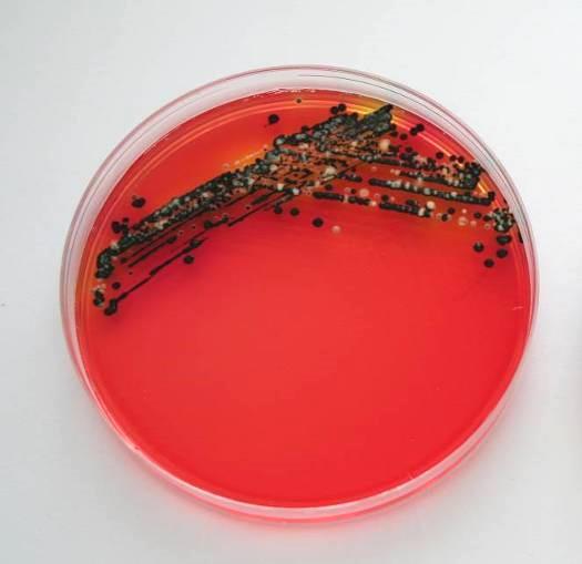 Figure A1 Salmonella isolated from wastewater growing on xylose lysine desoxycholate agar Figure A2 Salmonella isolated from wastewater growing on brilliant green agar A9.5 