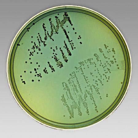 Figure B2 Colonies of Shigella and Salmonella on modified Hektoen agar Shigella species (dark green colonies) with Salmonella species (light blue-green colonies). B9.